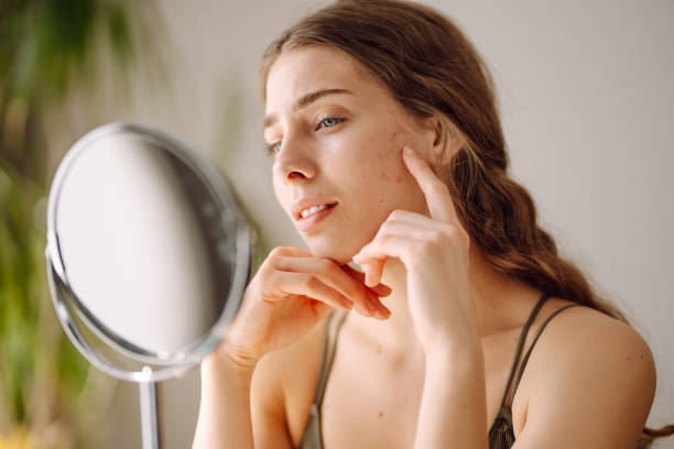 Pigmentation treatment