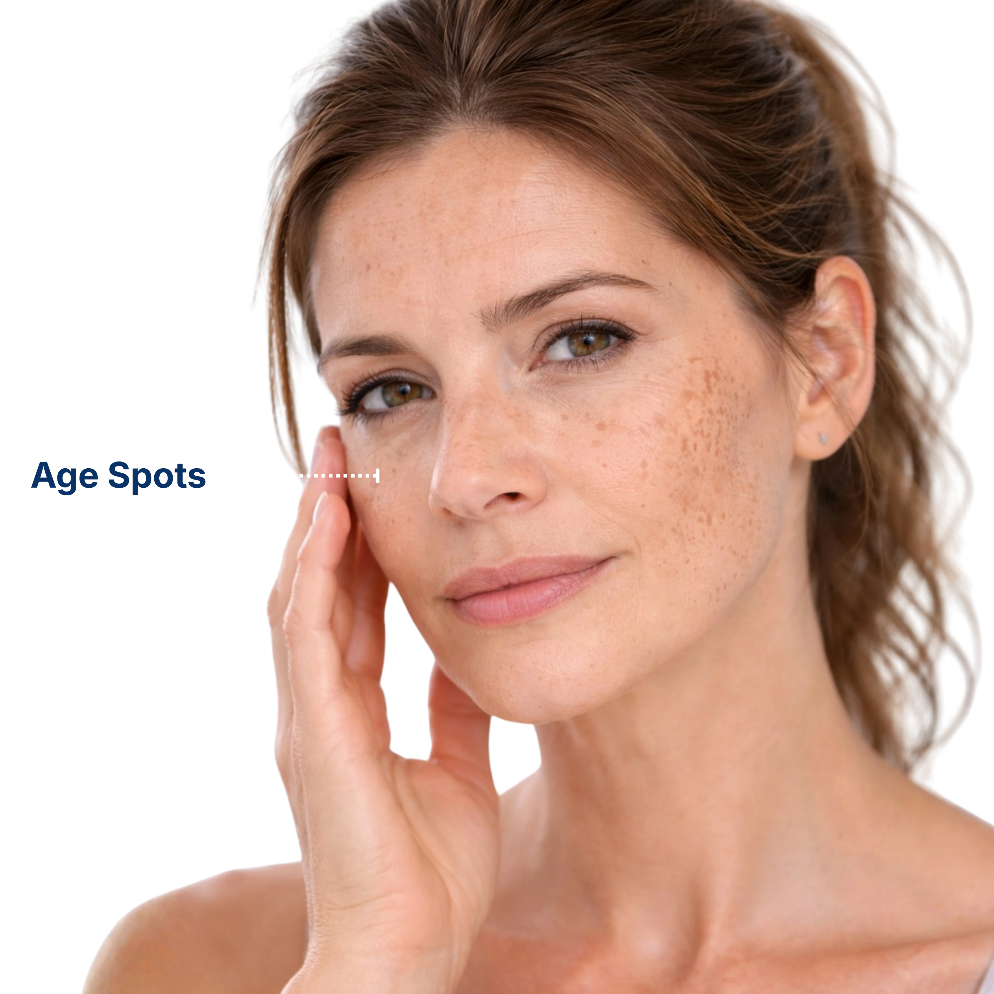 Pigmentation Treatment 1