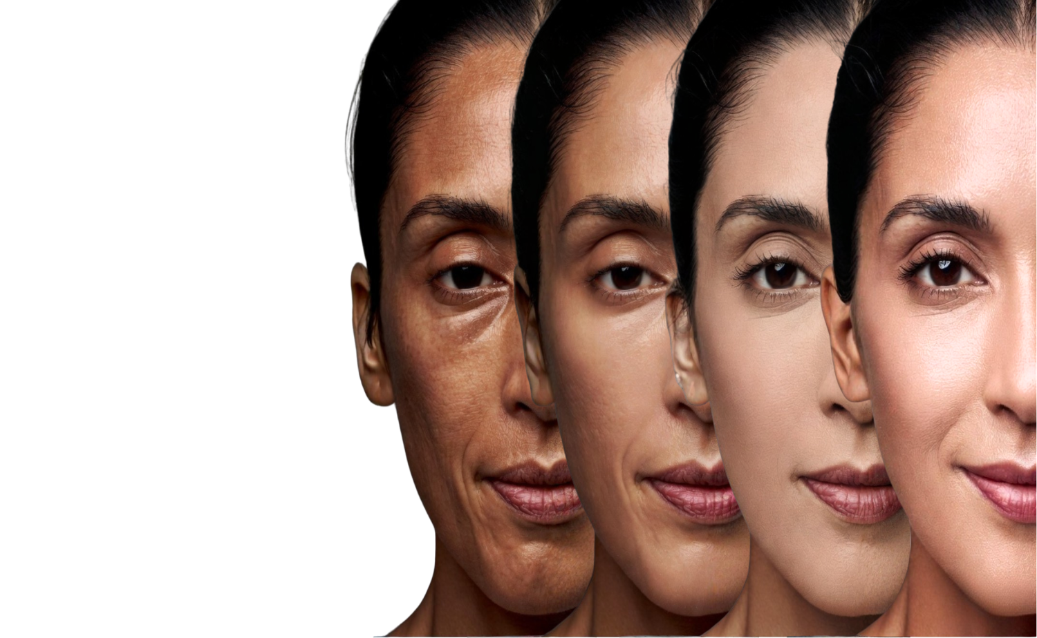Skin Whitening at Delhi Derma Clinic